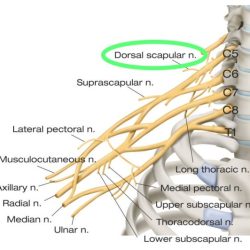 Nerve dorsal scapular entrapment